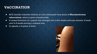VACCINATION
● BCG (bacille Calmette–Guérin) is a live attenuated virus strain of Mycobacterium
tuberculosis, which is given intradermally.
● It causes formation of a papule that enlarges over a few weeks and may ulcerate. It heals
over 6–8 weeks leaving a residual scar.
● In uganda, it is given at birth.
 