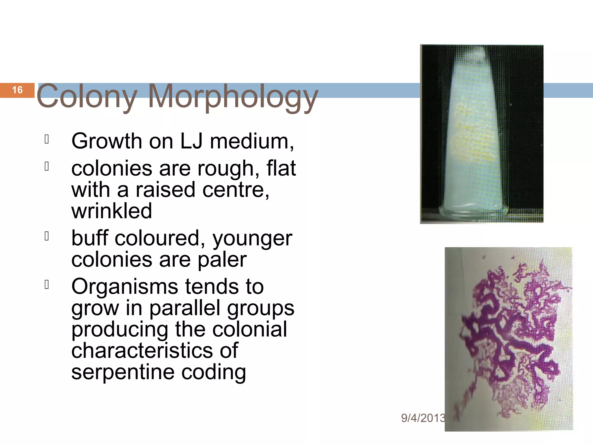 Tb presentation lab diagosis sept 2013 | PPT
