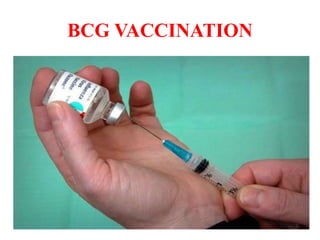 BCG VACCINATION
 