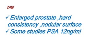 TB Prostate,Prostatitis,Prostate Abscess | PPTX