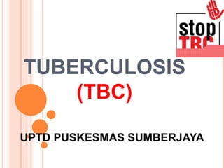 TUBERCULOSIS
(TBC)
UPTD PUSKESMAS SUMBERJAYA
 