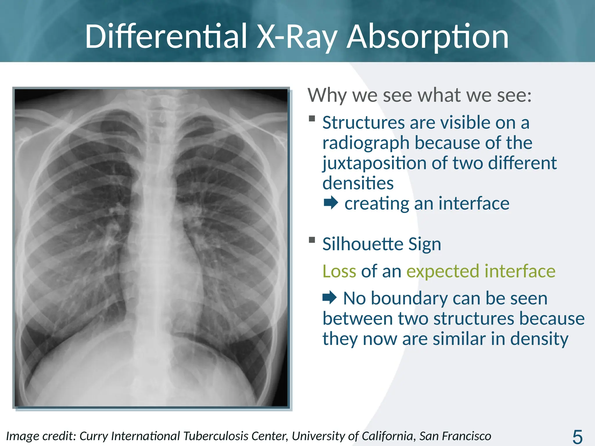 tb_radiology_basic_presentation_slides.pptx