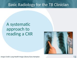 tb_radiology_basic_presentation_slides.pptx
