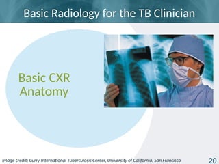 tb_radiology_basic_presentation_slides.pptx