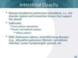 Typical Reticulation Line tb_radiology_basic_presentation_slides.pptx