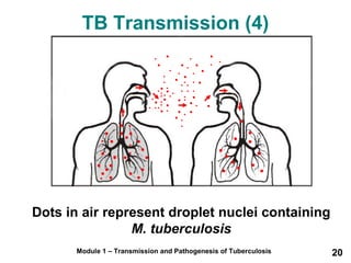 TB Transmission (4) 
Dots in air represent droplet nuclei containing 
M. tuberculosis 
Module 1 – Transmission and Pathogenesis of Tuberculosis 20 
 