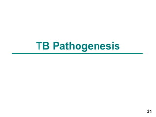 31 
TB Pathogenesis 
 