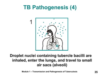 TB Pathogenesis (4) 
Droplet nuclei containing tubercle bacilli are 
inhaled, enter the lungs, and travel to small 
air sacs (alveoli) 
Module 1 – Transmission and Pathogenesis of Tuberculosis 35 
 