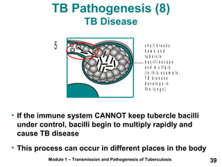 TB Pathogenesis (8) 
TB Disease 
s h e l l b r e a k s 
d o w n a n d 
t u b e r c l e 
b a c i l l i e s c a p e 
m u l t i p l y 
a n d 
( i n t h i s e x a m p l e , 
T B d i s e a s e 
d e v e l o p s i n 
t h e l u n g s ) 
5 
• If the immune system CANNOT keep tubercle bacilli 
under control, bacilli begin to multiply rapidly and 
cause TB disease 
• This process can occur in different places in the body 
Module 1 – Transmission and Pathogenesis of Tuberculosis 39 
 