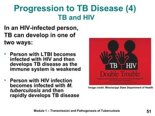 Progression to TB Disease (4) 
TB and HIV 
In an HIV-infected person, 
TB can develop in one of 
two ways: 
• Person with LTBI becomes 
infected with HIV and then 
develops TB disease as the 
immune system is weakened 
• Person with HIV infection 
becomes infected with M. 
tuberculosis and then 
rapidly develops TB disease 
Image credit: Mississippi State Department of Health 
Module 1 – Transmission and Pathogenesis of Tuberculosis 51 
 