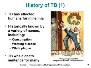 History of TB (1) 
• TB has affected 
humans for millennia 
• Historically known by 
a variety of names, 
including: 
– Consumption 
– Wasting disease 
– White plague 
• TB was a death 
sentence for many 
Vintage image circa 1919 
Image credit: National Library of Medicine 
Module 1 – Transmission and Pathogenesis of Tuberculosis 7 
 