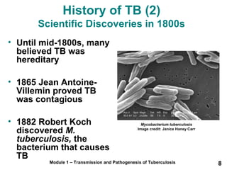 History of TB (2) 
Scientific Discoveries in 1800s 
• Until mid-1800s, many 
believed TB was 
hereditary 
• 1865 Jean Antoine- 
Villemin proved TB 
was contagious 
• 1882 Robert Koch 
discovered M. 
tuberculosis, the 
bacterium that causes 
TB 
Mycobacterium tuberculosis 
Image credit: Janice Haney Carr 
Module 1 – Transmission and Pathogenesis of Tuberculosis 8 
 