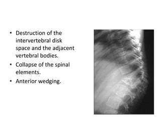 • Destruction of the
intervertebral disk
space and the adjacent
vertebral bodies.
• Collapse of the spinal
elements.
• Anterior wedging.
 