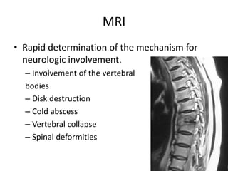 MRI
• Rapid determination of the mechanism for
neurologic involvement.
– Involvement of the vertebral
bodies
– Disk destruction
– Cold abscess
– Vertebral collapse
– Spinal deformities
 