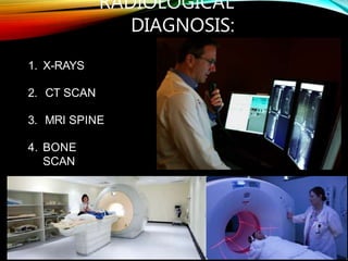 RADIOLOGICAL
DIAGNOSIS:
1. X-RAYS
2. CT SCAN
3. MRI SPINE
4. BONE
SCAN
 