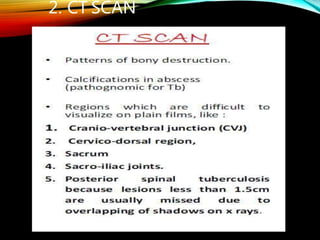2. CT SCAN
 