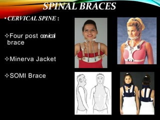 •CERVICAL SPINE :
Four post cervical
brace
Minerva Jacket
SOMI Brace
 