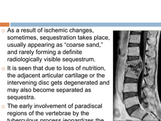 As a result of ischemic changes,
sometimes, sequestration takes place,
usually appearing as “coarse sand,”
and rarely forming a definite
radiologically visible sequestrum.
 It is seen that due to loss of nutrition,
the adjacent articular cartilage or the
intervening disc gets degenerated and
may also become separated as
sequestra.
 The early involvement of paradiscal
regions of the vertebrae by the
 