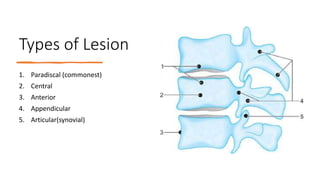 Types of Lesion
1. Paradiscal (commonest)
2. Central
3. Anterior
4. Appendicular
5. Articular(synovial)
 