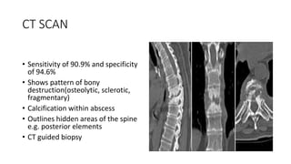 CT SCAN
• Sensitivity of 90.9% and specificity
of 94.6%
• Shows pattern of bony
destruction(osteolytic, sclerotic,
fragmentary)
• Calcification within abscess
• Outlines hidden areas of the spine
e.g. posterior elements
• CT guided biopsy
 