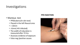 Investigations
PPD INJECTION
• Mantoux test
• PPD(tuberculin skin test)
• Placed in the left flexural area
• > 10mm
• >5mm( HIV infected)
• The width of induration is
measured after 72 hrs.
• Accesses evidence of exposure
• False neg /positive causes
 