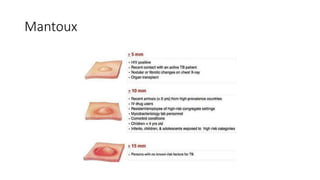 Mantoux
 