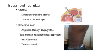 Treatment: Lumbar
• Abscess
• Lumbar paravertebral abscess
• Transpedicular drainage
• Decompression
• Approach through Hypogastric
para median trans peritoneal approach.
• Retroperitoneal
• Transperitoneal
 