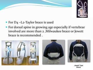  For D4 –L2-Taylor brace is used
 For dorsal spine in growing age especially if vertebrae
involved are more than 2 ,Milwaukee brace or Jewett
brace is recommended .
 