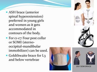  ASH brace (anterior
spinal hyperextension)
preferred in young girls
and women as it gets
accommodated in
contours of the body.
 For c1-c7 Four post collar
or SOMI (sterno-
occipital-mandibular
immobilizer) can be used.
 Goldthwaite brace for L3
and below vertebrae
 