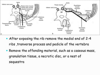  After exposing the rib remove the medial end of 2-4
ribs ,tranverse process and pedicle of the vertebra
 Remove the offending material, such as a caseous mass,
granulation tissue, a necrotic disc, or a nest of
sequestra
 