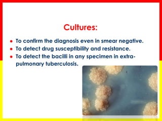 Cultures: 
To confirm the diagnosis even in smear negative. 
To detect drug susceptibility and resistance. 
To detect the bacilli in any specimen in extra- pulmonary tuberculosis.  