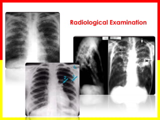 Radiological Examination  