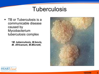 TB Terminology | PPT