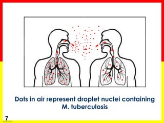 Module 1 – Transmission and Pathogenesis of Tuberculosis 
7 
Dots in air represent droplet nuclei containing 
M. tuberculosis  