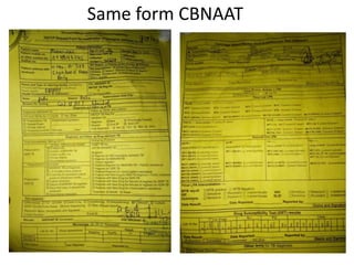 Cbnaat Form.pdf PULMONARY TUBERCULOSIS lecture new.pptx