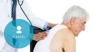 CAS(2)
 