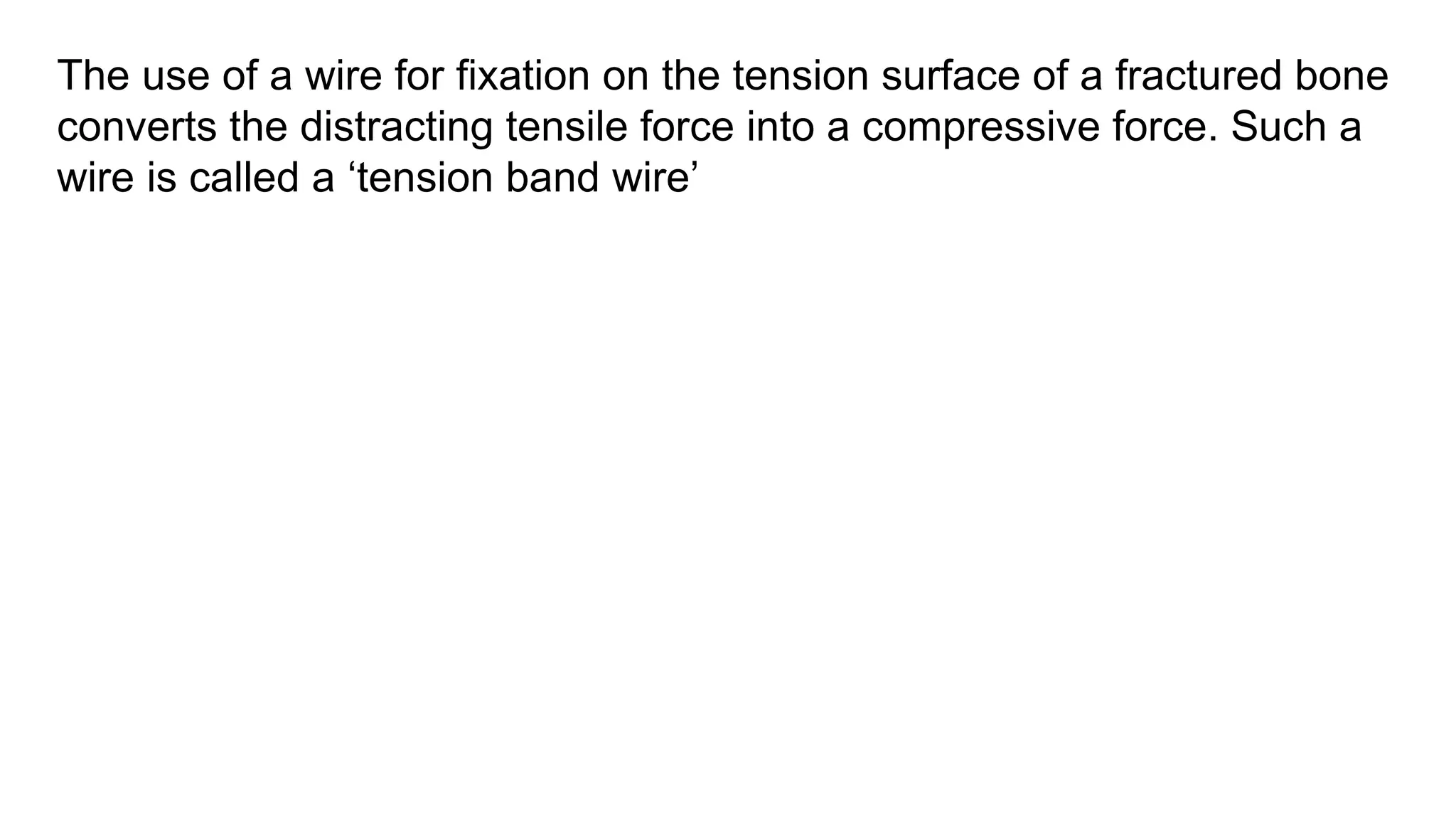 The use of a wire for fixation on the tension surface of a fractured bone
converts the distracting tensile force into a compressive force. Such a
wire is called a ‘tension band wire’
 