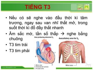 www.themegallery.com
TIẾNG T3
• Nếu có sẽ nghe vào đầu thời kì tâm
trương, ngay sau van nhĩ thất mở, trong
suốt thời kì đổ đầy thất nhanh
• Âm sắc mờ, tần số thấp  nghe bằng
chuông
• T3 tim trái
• T3 tim phải
 