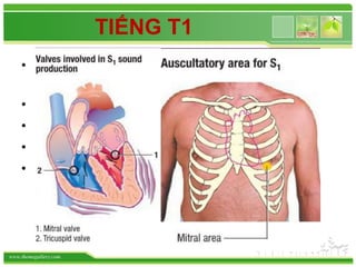 www.themegallery.com
TIẾNG T1
• Do sự đóng van 2 lá và van 3 lá trong thì
tâm thu
• Nghe lớn nhất ở mỏm tim
• Tần số cao  nghe bằng màng
• T1 tách đôi ?
• Các yếu tố ảnh hưởng cường độ T1?
 