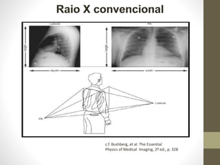 c.f. Bushberg, et al. The Essential
Physics of Medical Imaging, 2ª ed., p. 328
 