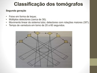 Segunda geração
• Feixe em forma de leque;
• Múltiplos detectores (cerca de 30);
• Movimento linear do sistema tubo; detectores com rotações maiores (30º);
• Tempo de varredura em torno de 20 a 60 segundos.
 