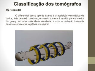 TC Helicoidal
O diferencial desse tipo de exame é a aquisição volumétrica de
dados, feita de modo contínuo, enquanto a mesa é movida para o interior
do gantry em uma velocidade constante e com a radiação ionizante
desenvolvendo uma trajetória em espiral.
 