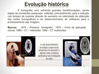 Marcos: 1970 – Primeiro tomógrafo; 1972 – Início da aplicação
clínica; 1989 – CT – helicoidal; 1992 – CT multicortes
A tomografia vem sofrendo grandes transformações, sendo
objeto de constantes pesquisas, voltadas, principalmente, para a redução
nos tempos de exames através do aumento na velocidade de obtenção
dos cortes tomográficos e do desenvolvimento de softwares para o
processamento das imagens.
 