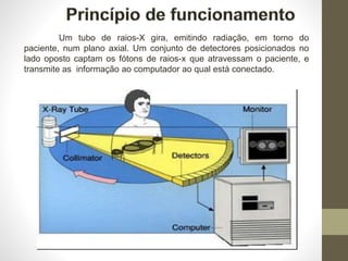 Um tubo de raios-X gira, emitindo radiação, em torno do
paciente, num plano axial. Um conjunto de detectores posicionados no
lado oposto captam os fótons de raios-x que atravessam o paciente, e
transmite as informação ao computador ao qual está conectado.
 