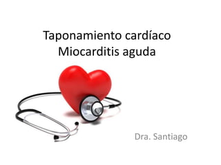 Taponamiento cardíaco
Miocarditis aguda
Dra. Santiago
 