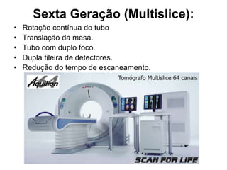 Sexta Geração (Multislice):
• Rotação contínua do tubo
• Translação da mesa.
• Tubo com duplo foco.
• Dupla fileira de detectores.
• Redução do tempo de escaneamento.
 