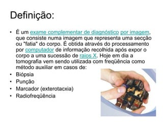 Definição:
• É um exame complementar de diagnóstico por imagem,
que consiste numa imagem que representa uma secção
ou "fatia" do corpo. É obtida através do processamento
por computador de informação recolhida após expor o
corpo a uma sucessão de raios X. Hoje em dia a
tomografia vem sendo utilizada com freqüência como
método auxiliar em casos de:
• Biópsia
• Punção
• Marcador (exterotacxia)
• Radiofreqüência
 