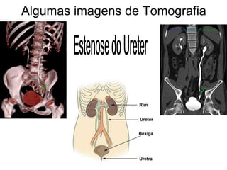 Algumas imagens de Tomografia
 