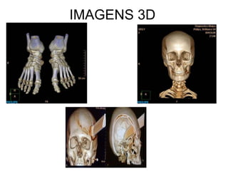 IMAGENS 3D
 