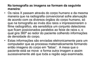 Na tomografia as imagens se formam da seguinte
maneira:
• Os raios X passam através do corpo humano e da mesma
maneira que na radiografia convencional sofre atenuação
de acordo com os diversos órgãos do corpo humano, só
que na tomografia ao invés dos raios x impressionarem o
filme radiográfico, ela sensibiliza um conjunto detectores
que ficam posicionados paralelos ao feixe de raios x, o
qual gira 360º ao redor do paciente colhendo informações
de densidade do corpo.
• Estas informações são enviadas eletronicamente para um
computador que as processa matematicamente formando
então imagens do corpo em “fatias”. A mesa que o
paciente está se move e forma outra imagem e assim
sucessivamente até que toda a região seja examinada.
 